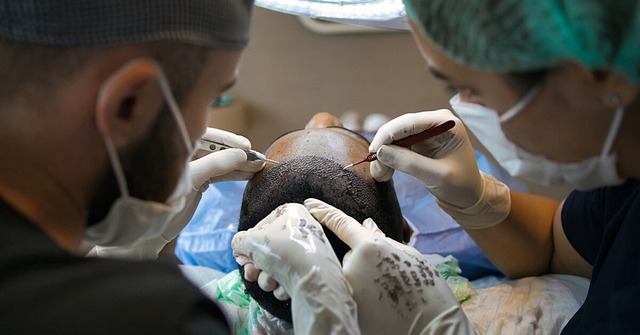 Hårtransplantationer: Den effektive løsning på hårtab hos mænd